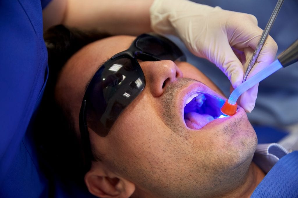 Dental Fillings